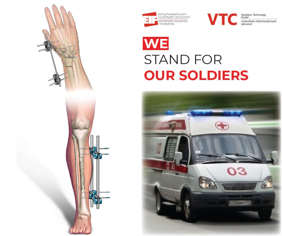 ՎՏԿ-ն նախագծում և պատրաստում է զինվորների բեկորային վնասվածքների հետևանքների բուժման համար անհրաժեշտ հատուկ օրթոփեդիկ սարքեր