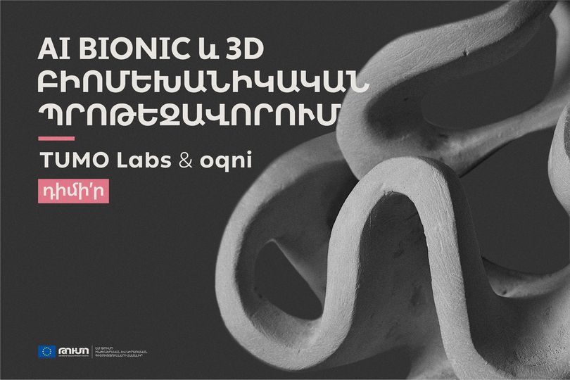 Թումո լաբերը և oqni-ին մեկնարկում են AI Bionic և 3D բիոմեխանիկական պրոթեզավորում նախագիծ